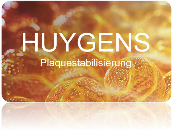 huygens
